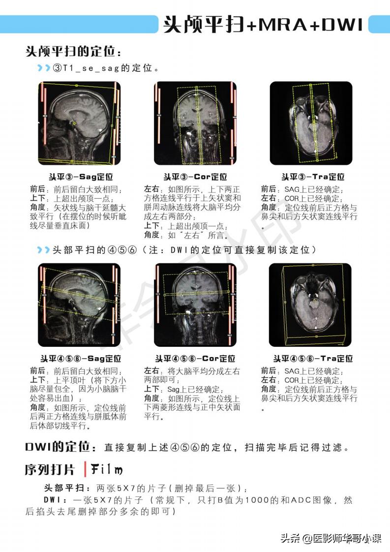 磁共振扫描技术西门子,西门子磁共振最新操作界面