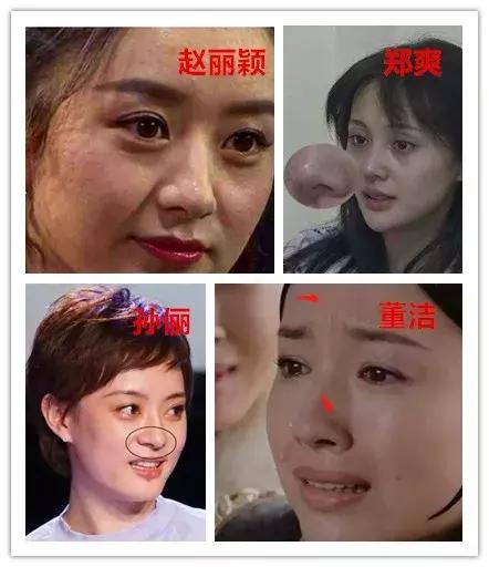 用芦荟胶去除粉刺,芦荟胶真的可以去黑头吗