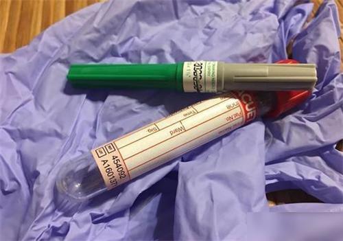 最罕见的血型在江苏被发现,江苏出现罕见血型