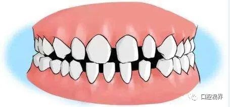 听说牙缝太大难看又露财，您给看看这牙缝还有救吗？