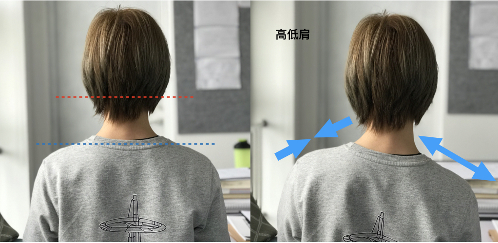 颈椎康复就一招,改善颈椎的有效缓解方法