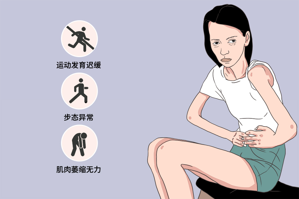 肌营养不良累及心脏,进行性肌营养不良基因48到51缺失