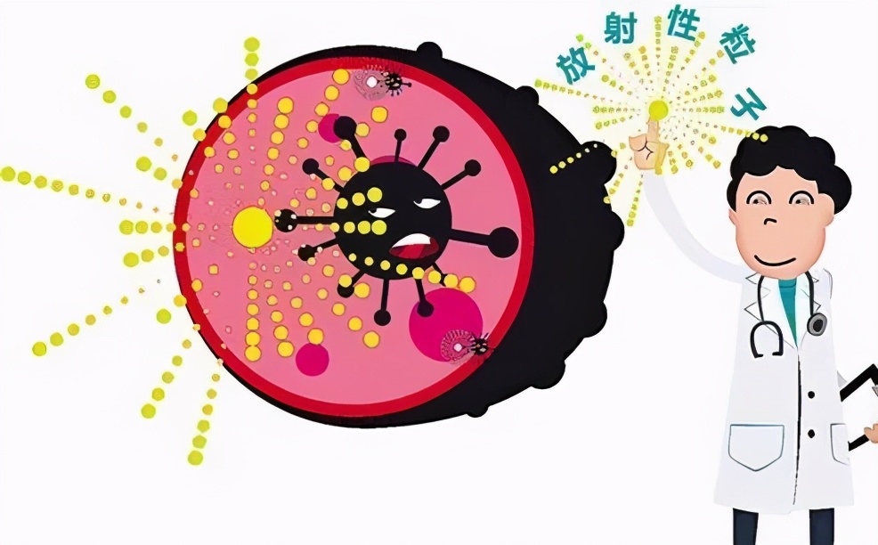 肿瘤康复神器,治疗肿瘤先进核技术