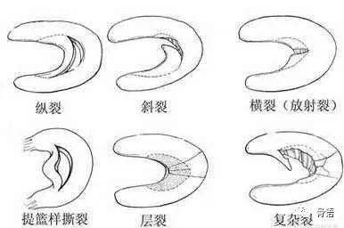 致敬韦德踩球,致敬韦德迷踪步