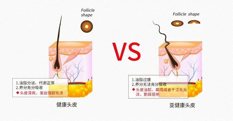 日本蒙琉洗发水,蒙古防掉发洗发水