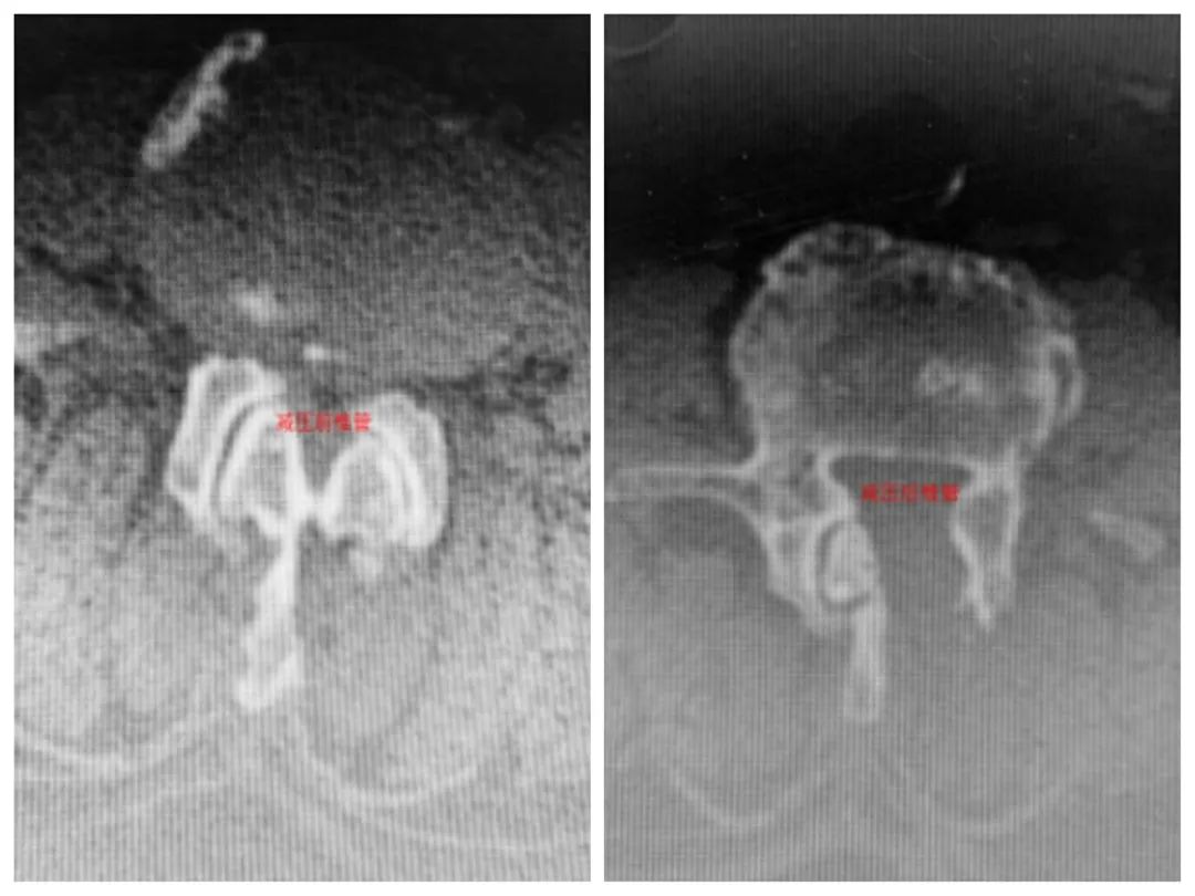 八旬老中医一招治怪病,江阴疑难杂症老中医