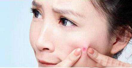 怎么预防脸上长痘痘,怎么预防孩子大了长痘痘