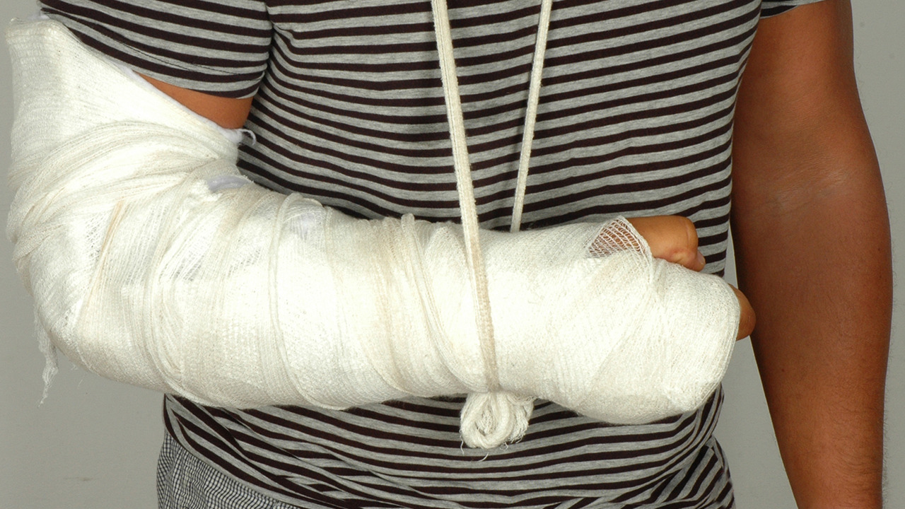 骨折固定的注意事项,骨折后需要注意哪里