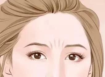 重度眉间纹,说说心里的那些事