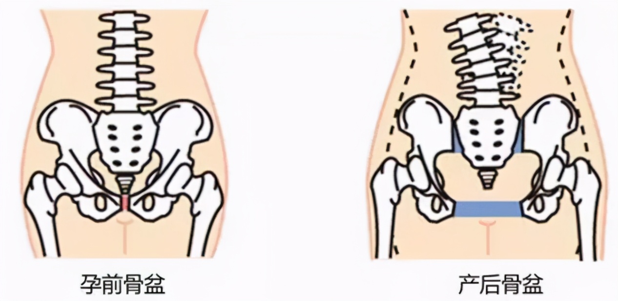 产后如何瘦脚最有效,生完宝宝胯宽怎么锻炼变窄