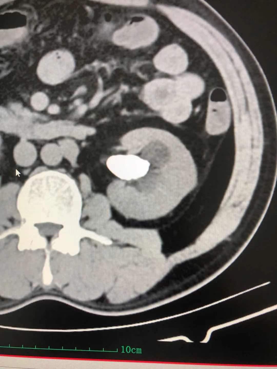 宝璋医院,利辛县宝璋医院泌尿外科怎么样