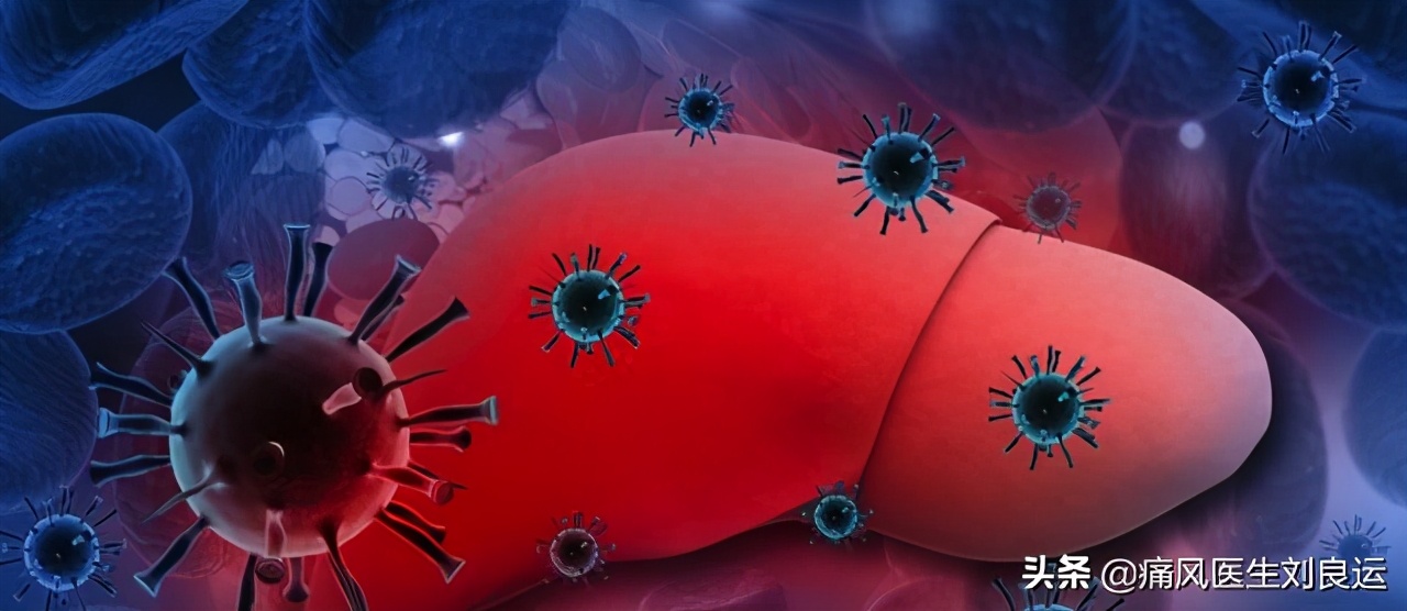 尿酸高吃什么药可降尿酸不伤肝,痛风吃什么降尿酸的药不伤肝