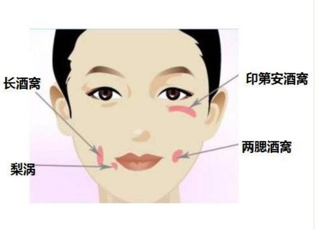 父母都没酒窝孩子有酒窝正常么,父母都没酒窝孩子怎么有