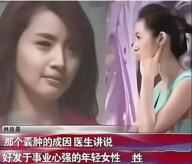 林依晨的婚姻危机,39岁林依晨结婚7年