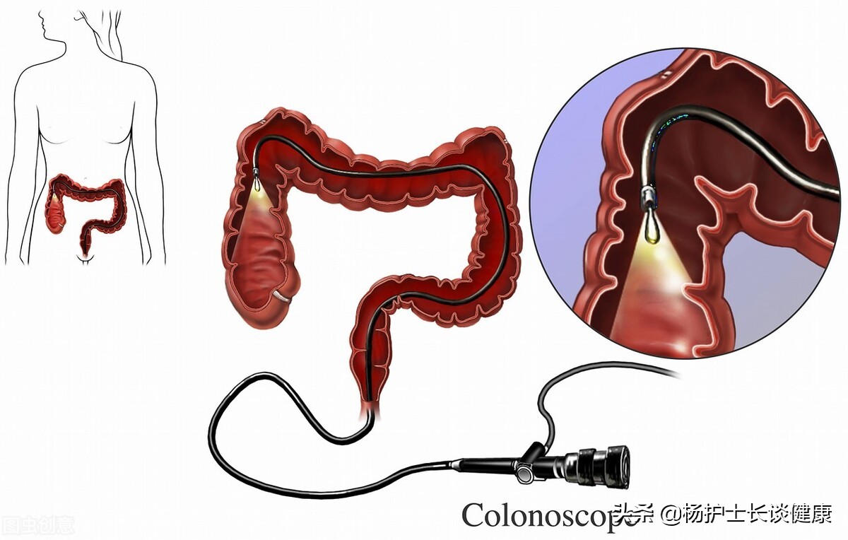 皮质醇低会不会骨质疏松,皮质醇增多症可以治好么