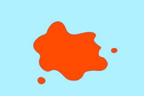 月经四种颜色代表什么,各种月经颜色说明什么问题