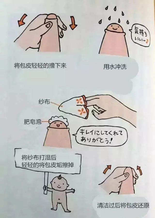 割包皮的几个棘手的情况,医院割包皮会不会被宰