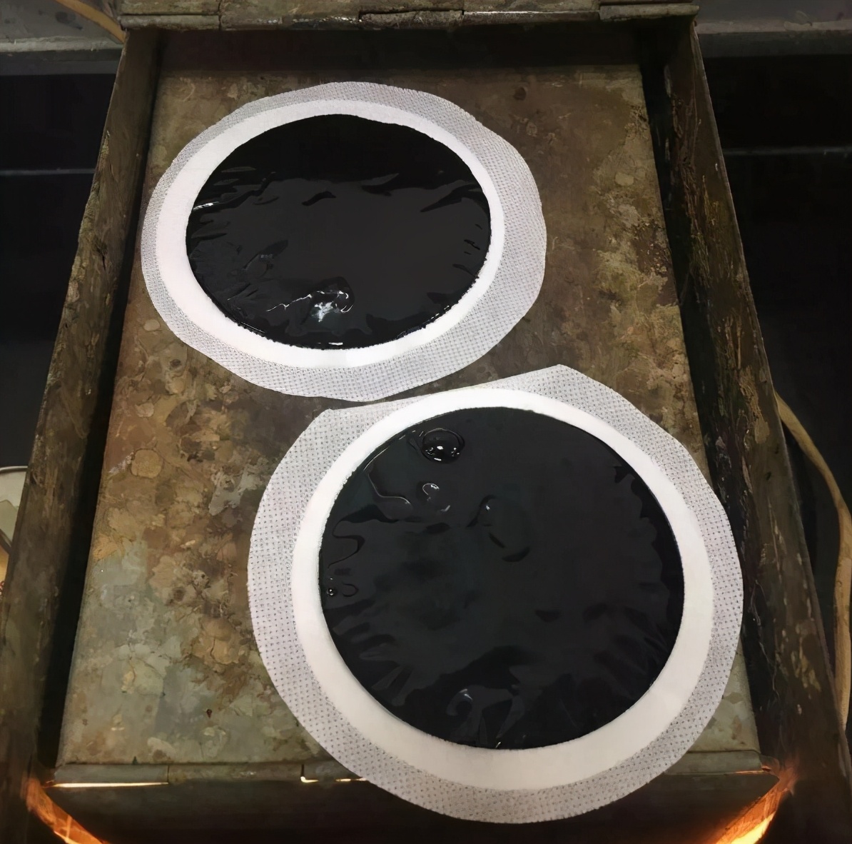 莆田系医院是如何崛起的,莆田系医院投资30万一年赚几千万