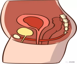 关爱你的盆底,紧握幸福