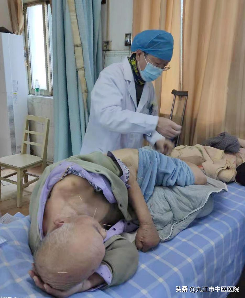 国医大师治中风偏瘫,中医推拿能让偏瘫恢复正常吗