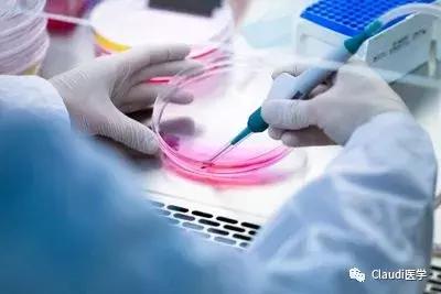 糖尿病急需干细胞突破,治疗糖尿病有最新科技突破吗