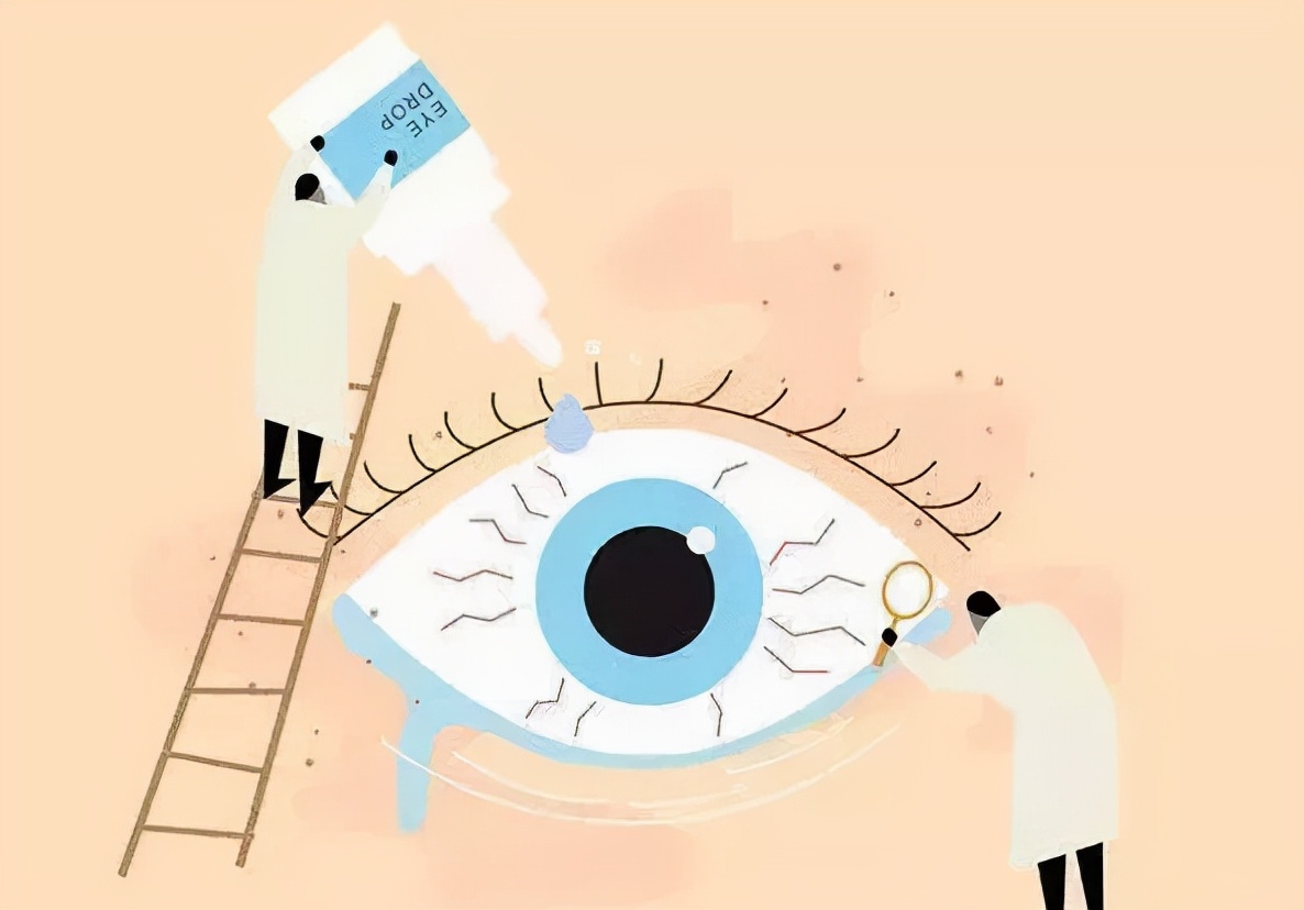 低浓度阿托品眼药水延缓近视咋样,孩子近视要滴阿托品药水吗