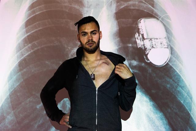 靠心脏起搏器持续足球梦想，现实版“钢铁侠”渴望执教德甲