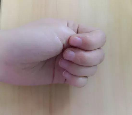 「生活资讯」秋来湿未去!有这几个症状的人,你湿气太重了!快学一招排湿毒