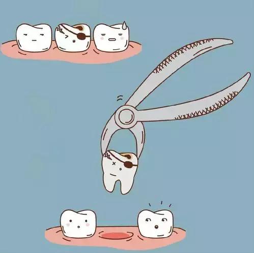 拔牙之后不能吐口水能用纸巾擦吗,拔牙后吐口水和吞口水有什么区别