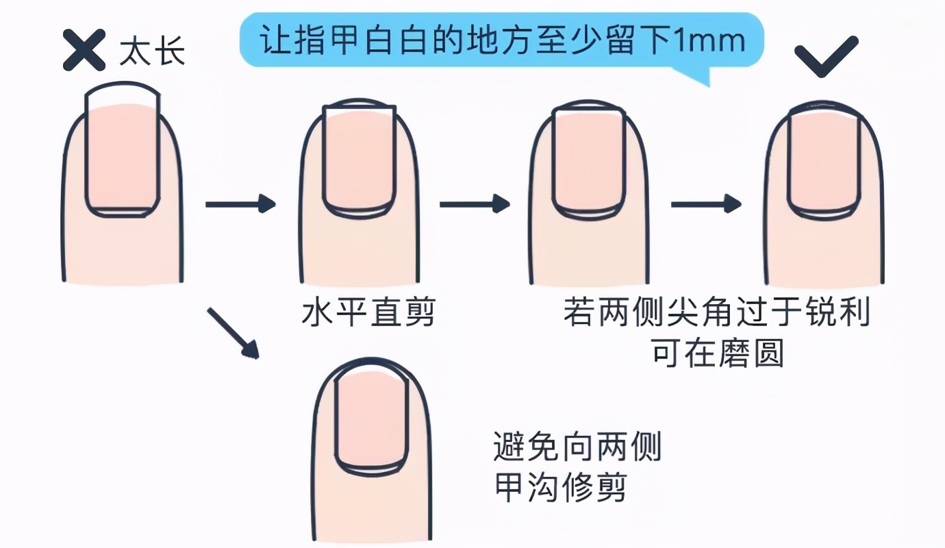 甲沟炎好痛怎么办,甲沟炎又疼又难受教你一招解决