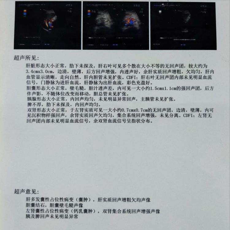 结节息肉囊肿增生哪个更容易癌变,结节囊肿增生息肉有什么区别