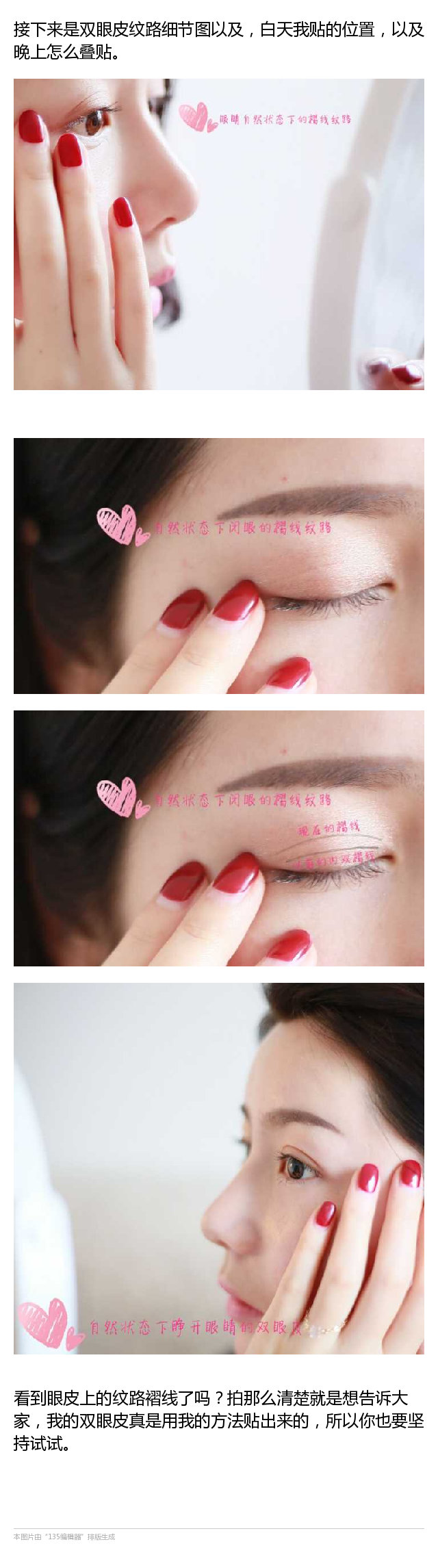 内双怎么才能自然变成双眼皮,内双怎么才能变成双眼皮