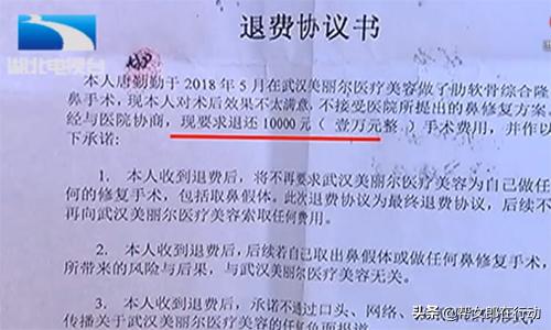 整容做成了朝天鼻,整容变朝天鼻