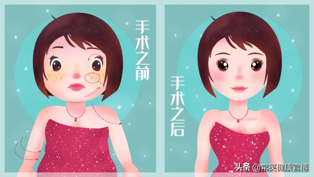 瘦肩针和瘦肩针一样么,瘦肩针30天效果图片