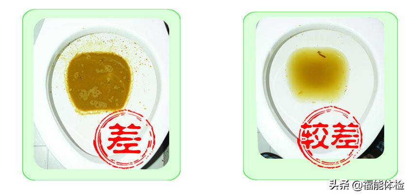 肠镜前清肠的正确方法,做肠镜前清肠的正确方法