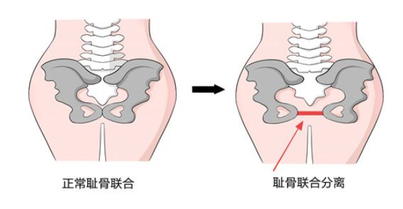 孕晚期恐慌怎么办,孕晚期痛到怀疑人生