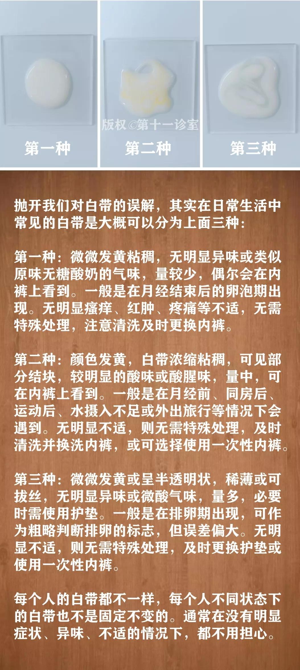 女人妇科白带的知识,女生白带冷知识