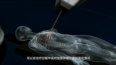 华东首秀！M6型射波刀落户国科大肿瘤医院