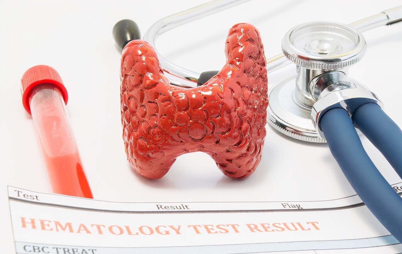 桥本甲状腺炎会使抗核抗体阳性吗,甲状腺抗体高一点就是桥本吗