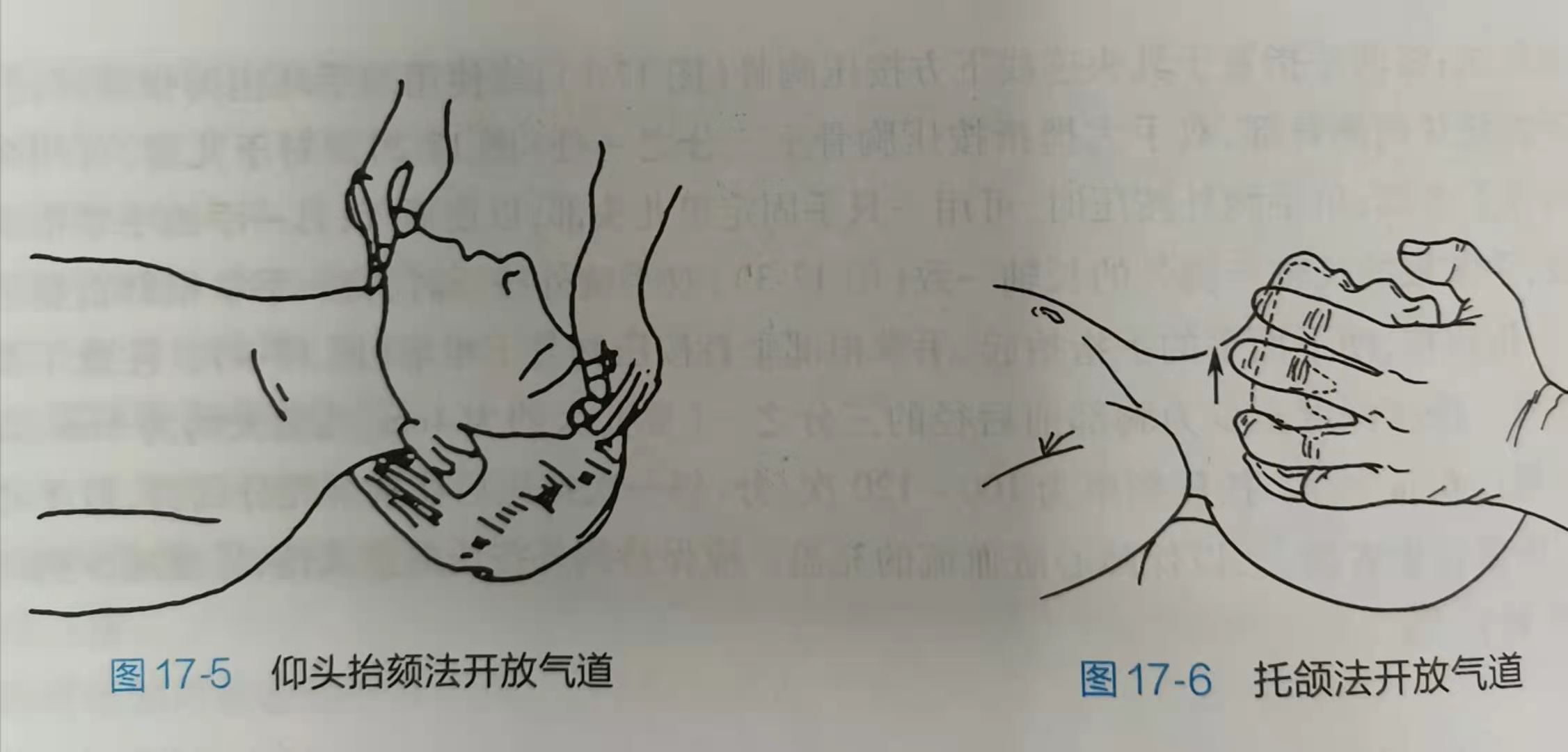 盘江总医院：家长们注意了！藏在幼儿衣物里的“隐形杀手”不容忽视