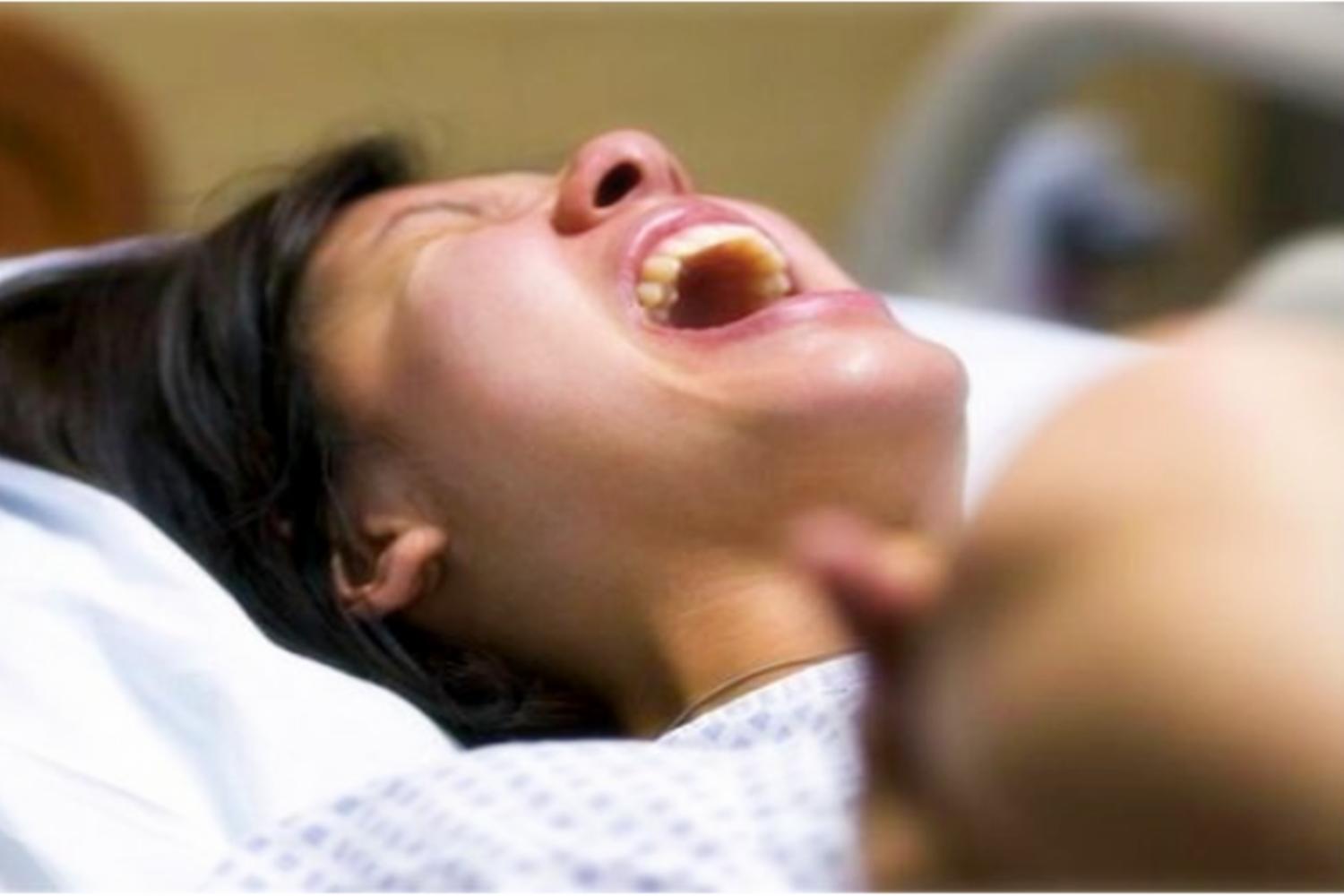 你以为生孩子最痛的是分娩吗,你以为的剖腹产实际的剖腹产