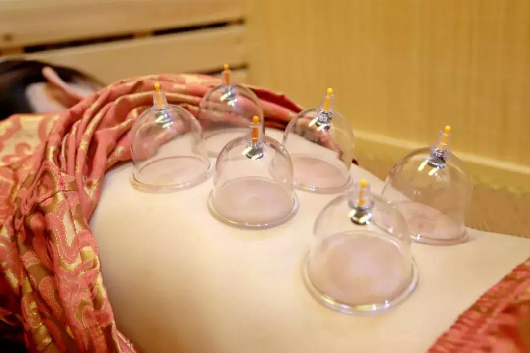 天津口碑好的中医推拿培训机构,天津拔罐