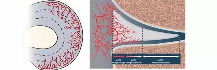 运动造成的半月板损伤的最好治疗,运动后半月板损伤怎么治疗