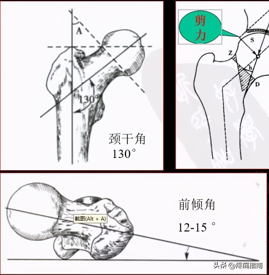 夏天无注射液能治疗骨头坏死吗,骨头坏死用针刀镜有用么
