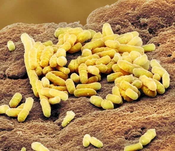 嘴馋老是想吃东西吃什么好,老是嘴馋要怎么抑制食欲