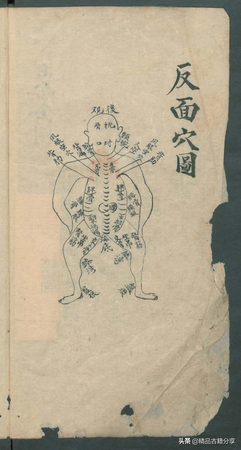 中医类抄本跌打损伤方面的医书欢迎阅读