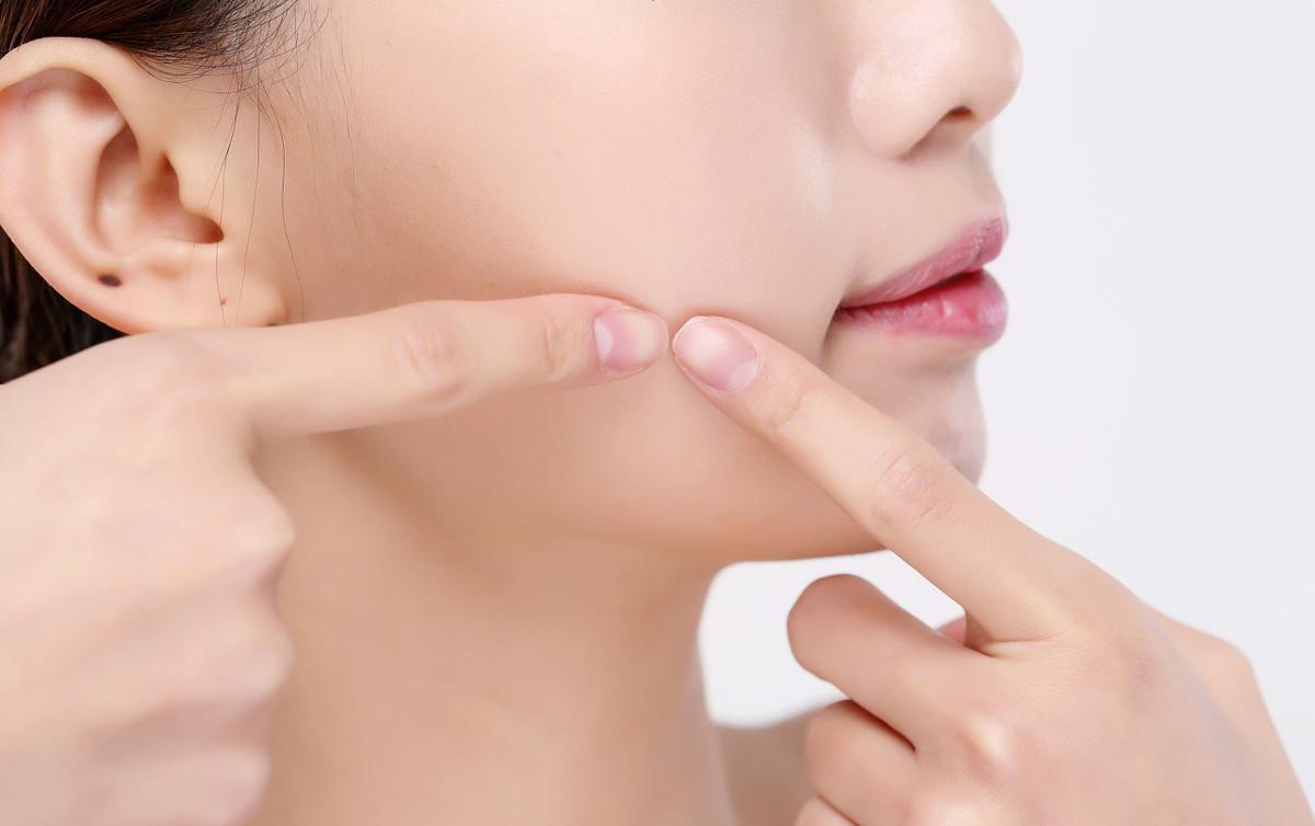 怎么去除脸上的黑痘印红痘印,祛后背痘印淡化痘印推荐