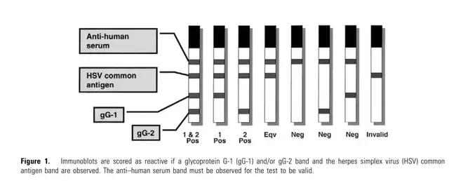 hsv干扰免疫应答及抗原选择,hsv病毒培养