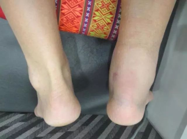 猛于虎伤病季后赛,勇士对猛龙汤普森受伤片段