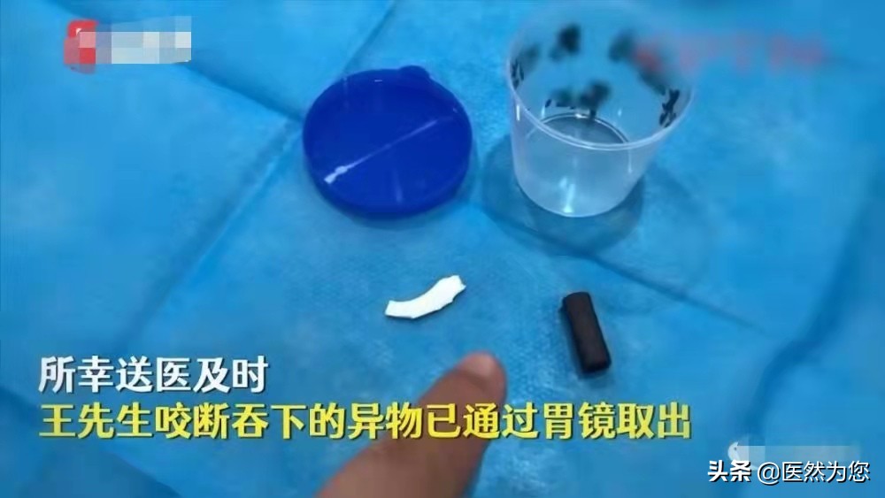 癫痫抽搐有什么症状,癫痫病抽搐症状有哪些